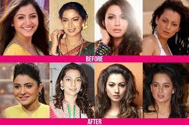 Desktop cosmetic suregry celebrity