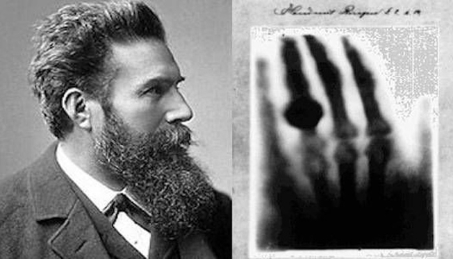 Desktop x rays rontgen2.jpg.1080x0 q100 crop scale